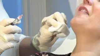 Introducing Profhilo  The Airbrushed Look