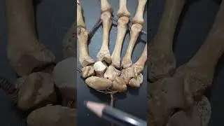 Carpal bones of hand #shorts #carpal #upperlimbanatomy #handanatomy