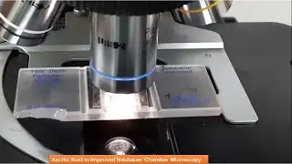 Cell counting of body fluid through Improved Neubauer Chamber Demonstrations