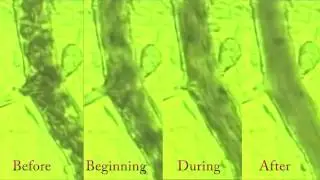 BEMER Circulation Before and After Side by Side Comparison