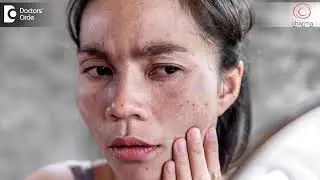 Chemical Peel vs. Laser Treatment: Choosing the Right Option for Your Skin -  Dr. Rajdeep Mysore