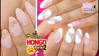 REGRESO la Clienta del HONGO 🍄😩/ Retoque Part.2 | NailsByKaren