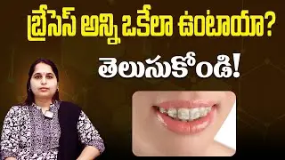 బ్రేసెస్ ఎన్ని రకాలు? వాటి మధ్య తేడా ఏంటి? | Types of Braces & Differences Explained in Telugu
