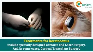 Keratoconus Treatment | NEYTRA Eye Care Clinic in Delhi, Saket | Dr. Priyanka Singh | Eye Surgeon