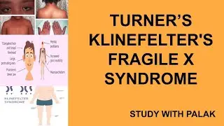 TURNER'S , KLINEFELTERS'S AND FRAGILE X SYNDROME- JKPSC 10+2 LECTURER EXAM ZOOLOGY- BY PALAK MAHAJAN