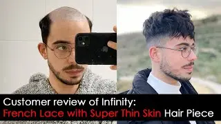 French Lace and Thin Skin Hair System: Get Your Hair Back with Lordhair!