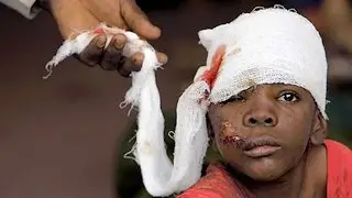 Haitian Aid Fraud.
