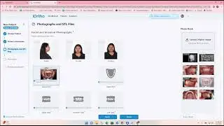 Submitting Angel Aligner Case
