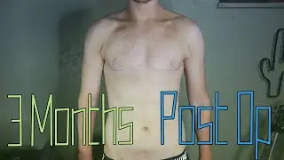 3 Months Post Op Top Surgery | FTM Transgender