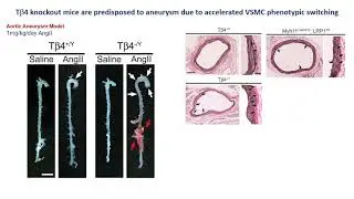 Thymosin &beta;4 protects against aortic aneurysm
