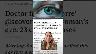 Doctor removes 23 contact lenses from woman&rsquo;s eye #shorts