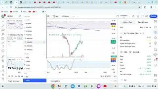 SILK ROAD MEDICAL stock prediction