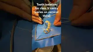 Tooth isolation for class V cavity #caries #toothdamage #toothisolation #treatment