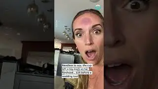 Suction Cup On Forehead Leaves Big Mark || ViralHog