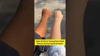 🔥Get Fair Hand in 5 Minutes/ Remove Suntan, Most Easy Manicure #skincare#manicure #shorts #ytshorts