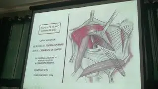 TECNICAS - HERNIAS  2/3