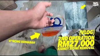 Operation Ke-2 Buang Batu Karang, Telan Belanja RM27,000!