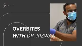 Why You Should Fix An Overbite, With Dr. Rizwan