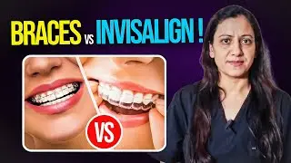 Invisalign or Braces: Which One is Good for You?  | Dr. Reema