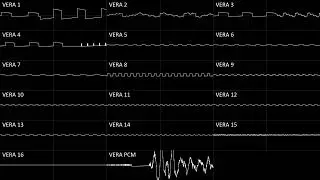 TurboGrafx-16 Doskpop / Pacodosk [Commander X16 VERA, Oscilloscope View]