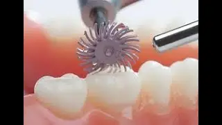Dental Lab Ceramic Bridge Finishing