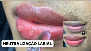 Neutralização Labial Em Lábios Com Diferentes Tons - Micropigmentação Labial