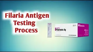 filaria antigen test II Card test