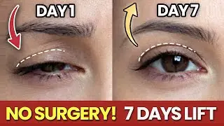 Lift Hooded Eyes & Look Younger Naturally | 7-Day Eye Yoga (No Surgery)