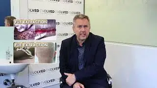 Questions To Ask Before Hair Transplant