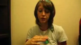Silver Ring Splints for Ehlers Danlos Syndrome