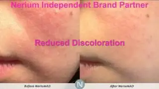 Wrinkle Treatment San Antonio | 210-305-7833