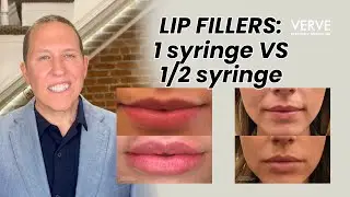 How Many Syringes of Lip Filler Do You ACTUALLY Need?  (1 syringe VS 1/2 syringe comparison)