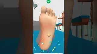 Foot Clinic Gameplay 🎯🎮 #1