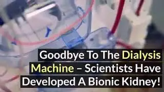 Bionic kidney replacing hemodialysis in the future #hemodialysis #american #medical #infokesihatan