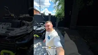 Пересадка Волос До После 👍🏻 Hair transplant before after