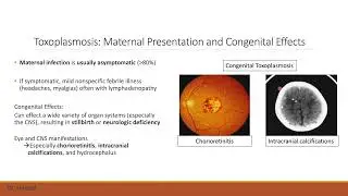 Gynecologic & Pregnancy Related Infections Part 4