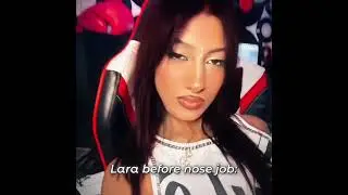 lara before vs after nose job #katseye