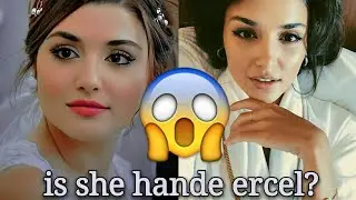 Turkish actress Hande ercel 😲before and after 😢