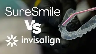 Suresmile vs Invisalign: Which ONE is Right for You?