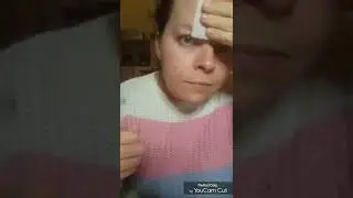 incredi-peel glycolic resurfacing pads. These works brilliantly.