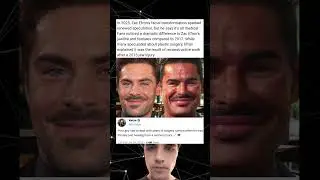 In 2025, Zac Efron&rsquo;s facial transformation sparked renewed speculation