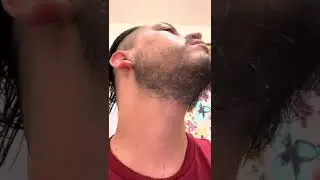 Minoxidil para la barba d&iacute;a 176
