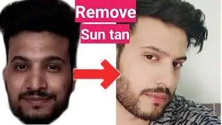 How To Remove SUN TAN from Face Naturally|Hindi|How to get rid of Sun Tan naturally|चेहरे से tan