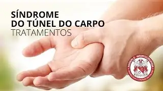 TRATAMENTOS Síndrome do Túnel do Carpo  - Dr Diogo Neurocirurgião