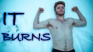 SNOW BATHING CHALLENGE! Skin got BURNT! 🔥❄️