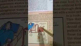 Grade 10 ,  Artificial kidney ( excretion.)