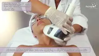 MeDioStar NeXT PRO XL - Training video for hair removal with BASIC mode from Asclepion