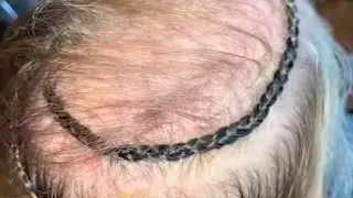 INVISIBLE HAIR EXTENSIONS! The Perfect Thin Hair & Hair loss Solution!