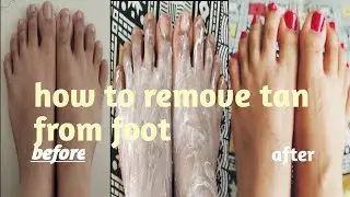 How to remove tanning from foot। How to do pedicure from modicare products।modicare products for tan