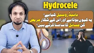 What Is Hydrocele? Causes, Symptoms, and Problems Patients Face | Dr. Faisal Anis Malik.